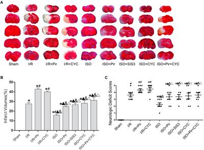 TGF-β2 Induces Gli1 in a Smad3-Dependent Manner Against Cerebral Ischemia/Reperfusion Injury After Isoflurane Post-conditioning in Rats